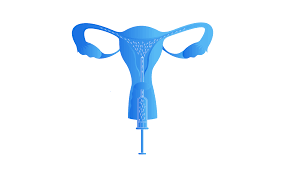 See full list on costaide.com Artificial Insemination Types Process Costs And More