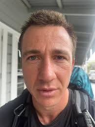 Hi, I had Bell's palsy over a year ago and the left side of my face has not  completly gone back to normal and my left eye is still smaller than my