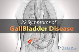 Your doctor may recommend surgery to remove your gallbladder, since gallstones frequently recur. 22 Symptoms Of Gallbladder Disease Drjockers Com