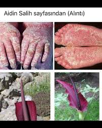 985 Begenme 32 Yorum Instagram Da Dogadan Eve Sedef Hastaligi Ve Dogal Tedavi Sola Kaydirarak Okuyun Draidinsalih Sedefhastaligi Meat Food Beef
