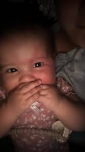 Has anyone experienced a swollen eye suddenly worsening?