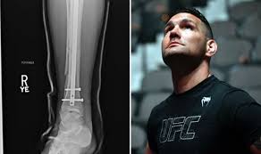 View this post on instagram a post shared by chris weidman (@chrisweidman) Chris Weidman Injury Former Ufc Champion Shares X Rays Of Broken Leg Ufc Sport Swiftheadline