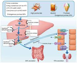 Image result for Hyperuricemia