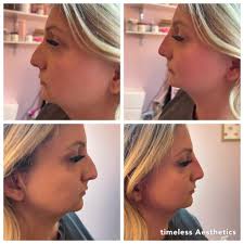 Timeless Aesthetics, LLC