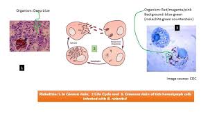 Image result for Rickettsiae