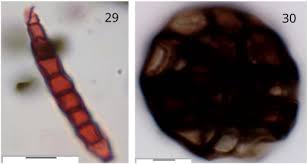 Image result for Ascolepis protea