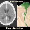 Neurovascular events after subarachnoid hemorrhage / m. 1