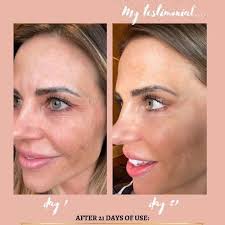 Soulfood Collagen For Customers Angela Grace