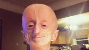 Fundraiser by Anna Laskowski : Devin