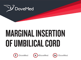 In this condition, the cord doesn't attach directly to the. Marginal Insertion Of Umbilical Cord