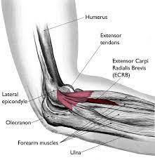 The enthesis encounters very high mechanical demands and the regenerative capacity is very low resulting in high rupture recurrence rates after. Tennis Elbow Lateral Epicondylitis Orthoinfo Aaos