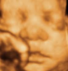 It gives a trained eye a look into the proper. 3d 4d Ultrasound Brooklyn New York Nyc 3d Ultrasound Brooklyn 4d Ultrasound Brooklyn 4d 3d Ultrasound 3d 4d Sonogram
