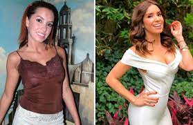 Fanpage oficial de andrea escalona. Cuchillo Y Silicona La Drastica Transformacion De Andrea Escalona Con Las Cirugias La Neta Noticias