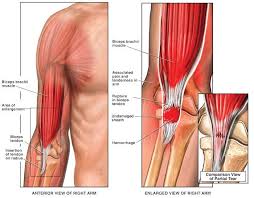 Help In Stretching Or Inflammation Of The Muscles Bicep Tendonitis Biceps Golfers Elbow
