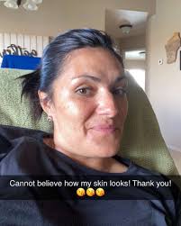 Lori buss (@skinbylorilou) • Instagram photos and videos