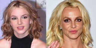 Anna is a communication expert and a life enthusiast. Plastic Surgery Before And After 9 Celebrities On What It S Really Like
