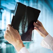 Revolutionair: bestaande medicijnen voorkomen dat kanker terugkeert -  Gazeta Express