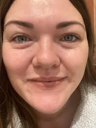 Embarrassingly I'm only 32 and my hooded lids and under eye is just  shocking. I do look after my skin so much but my eyes the past 12 months  have really aged