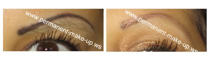 Diese sorgen dann dafür, dass die farbpigmente aus der heut gezogen werden. Permanent Make Up Entfernen