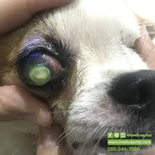 Juro….Thủy tinh thể ở mắt có dịch" - ivethospital
