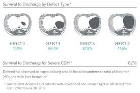 Congenital Diaphragmatic Hernia Cdh Fetal Diagnosis