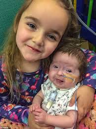 İki yaşlı qız "qoca nənə"yə çevrildi