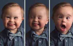 Este Nino Fue Rechazado De Una Campana Publicitaria Por Tener Sindrome De Down Dezvoltare Copii Copii