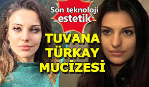 Tuvana türkay kim mk'cılar gelmeden belirteyim. Guzel Oyuncu Tuvana Turkay Estetik Mucizesi Cikti