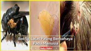 We did not find results for: Ngeri Larva Lalat Botfly Parasit Paling Berbahaya Yang Hidup Di Tubuh Manusia Youtube