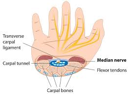 Historically the carpal tunnel syndrome used to be called a milkmaid disease, because. Median Nerve The Definitive Guide Biology Dictionary