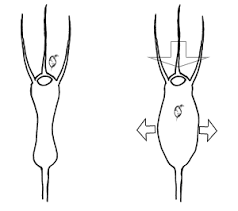 Image result for Utricularia baoulensis