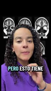Edad mínima para diagnóstico del TDAH en niños