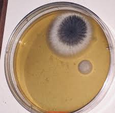 However, bear in mind that because the supplies are prepared ahead of time, these. Mold Identification Photographs Of Mold Growing On Petri Dishes Or Mold Culture Plates Or Settlement Plates