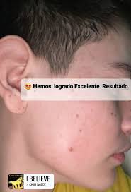 Dermatóloga Dra. Sonia Calles