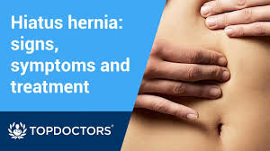 Hiatus Hernia Signs Symptoms And Treatment Youtube