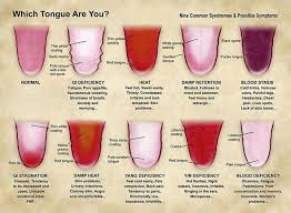 14 Problem Solving Chinese Medicine Tongue