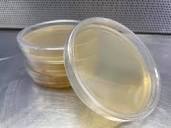 Sterile Pre-Poured LB Agar Plate [Individually Sealed] – Midnight ...