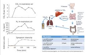 Image result for Lactase Deficiency