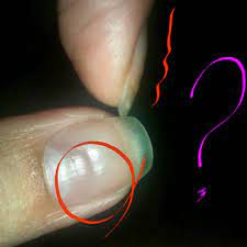 Почему пластина ногтя волнистая