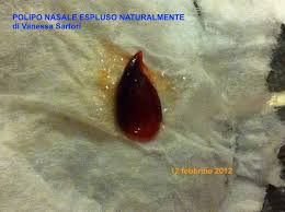 Molti di questi i rimedi della nonna riguardano l' alimentazione o l' omeopatia. Vanessa Sartori