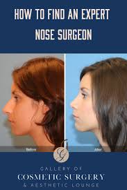 Last updated on aug 21, 2020. Cosmetic Surgery Near Me