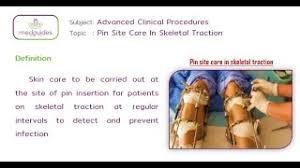 There are two types of traction: 29 Pin Site Care In Skeletal Traction Youtube