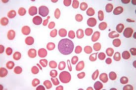 Image result for Red Blood Cell