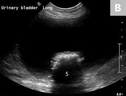 Imaging Of Calculi Of The Urinary System Clinician S Brief