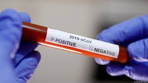 Wie Funktioniert Der Coronavirus Schnelltest Wissen Umwelt Dw 03 03 2020