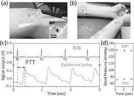The heart's beating pushes blood through the arteries causing a rise and fall of arterial pressure. Flexible Piezoresistive Sensor Patch Enabling Ultralow Power Cuffless Blood Pressure Measurement Luo 2016 Advanced Functional Materials Wiley Online Library