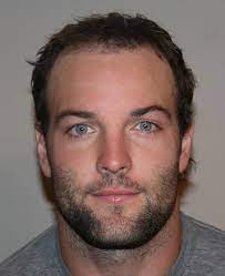 If you are like one of the 80 million american men and women experiencing hair loss, they understand how losing your hair can affect the way you think and feel about yourself, … Case 5757 Leonard Hair Transplant Associates