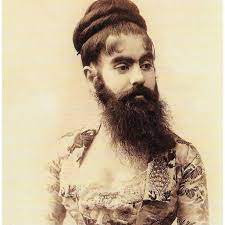 Barnum as a circus attraction. Portrait Of Annie Jones Elliot 1865 1902 Aka Esau Lady From Virginia Download Scientific Diagram