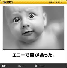 呼吸困難待ったなし あなたの腹筋を破壊する赤ちゃんのボケて 11選 赤ちゃん エコー 赤ちゃん おもしろ画像