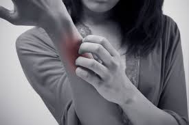 Skin Rash Types Symptoms Causes And Treatment